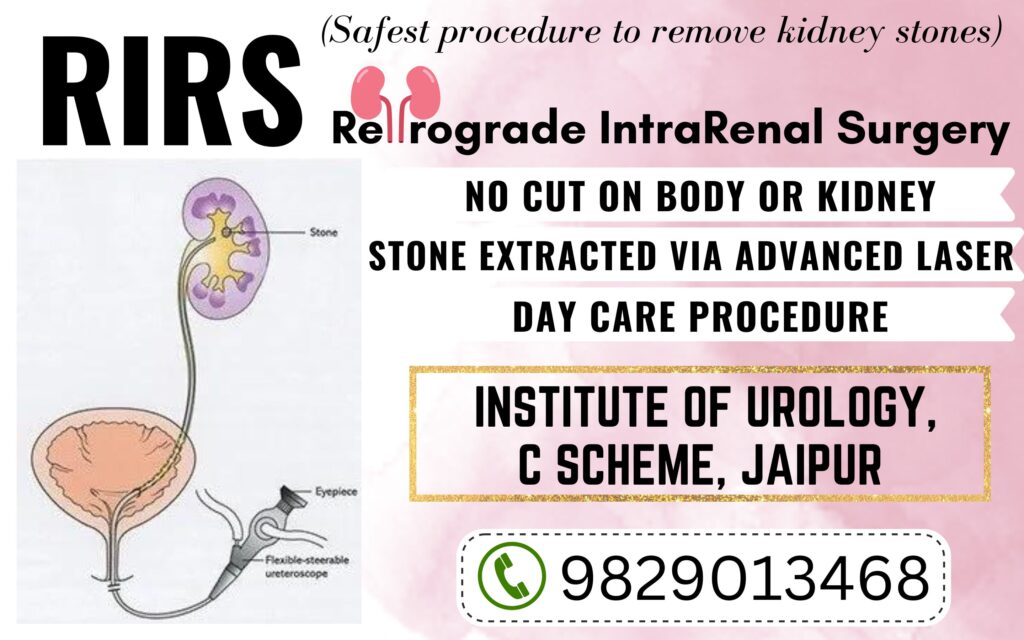 Best Hospital in Jaipur Rajasthan for RIRS Kidney stone laser surgery