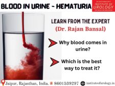 Hematuria Dr. Rajan Bansal Best Urologist in Jaipur Rajasthan India 8601539297