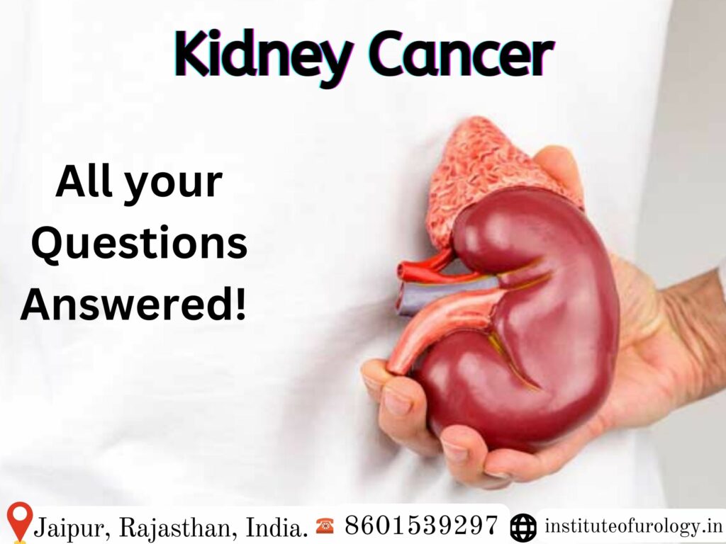 Kidney Cancer best doctor in rajasthan Dr. Rajan Bansal