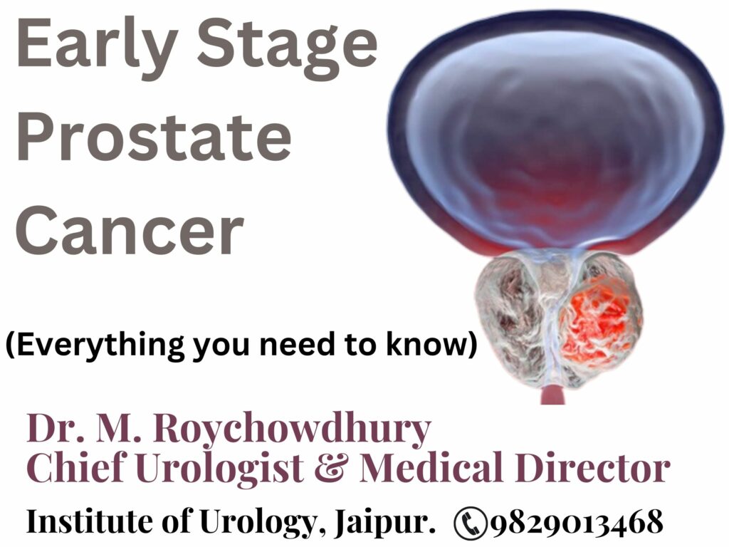 Early Stage Prostate Cancer - Everything you need to know