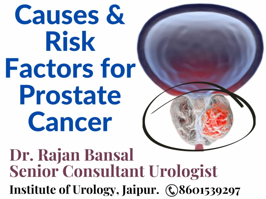 Prostate Cancer Dr. Rajan Bansal Causes Risk Factors Best Urologist in Jaipur Rajasthan