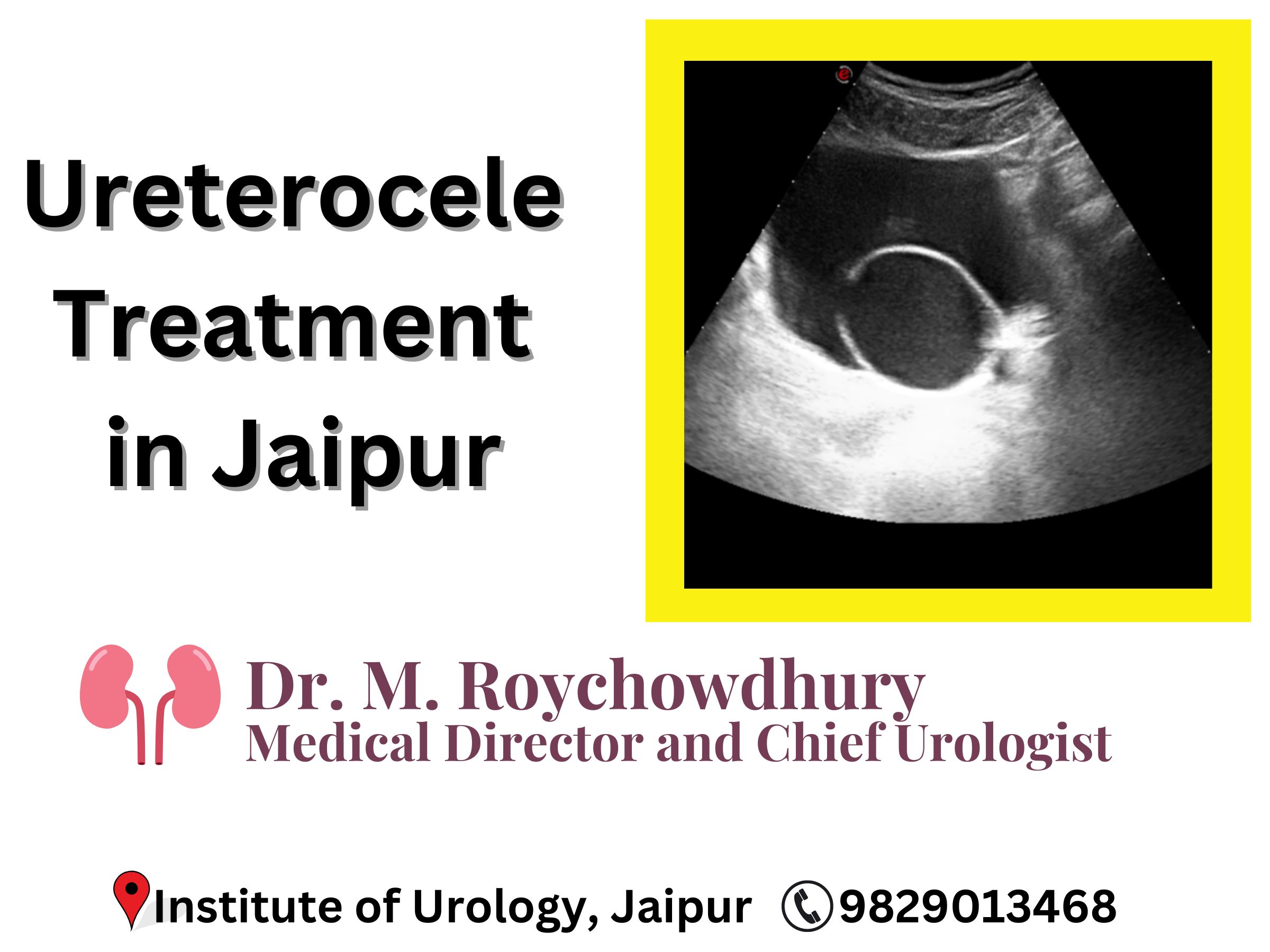 Ureterocele Treatment in Jaipur Best Hospital Institute of Urology Dr. M Roychowdhury C Scheme, Jaipur