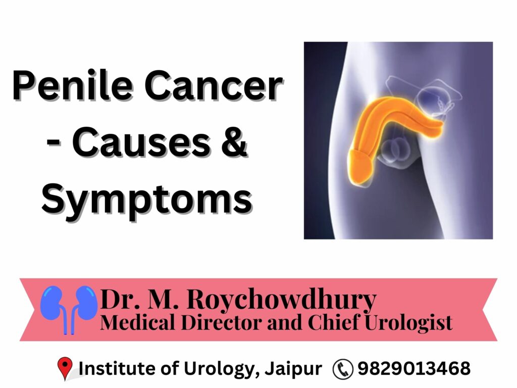 Penile Cancer Treatment in Jaipur Dholpur Rajasthan Dr. M Roychowdhury, Dr. Rajan Bansal