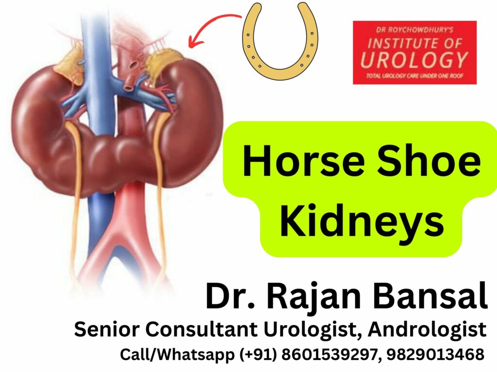 Horse Shoe Kidney Treatment Dr. Rajan Bansal MCh Urologist in Jaipur Tonk Churu Haryana Rajasthan