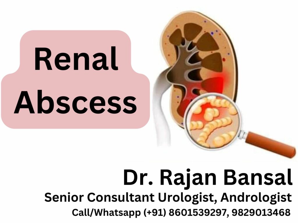 Renal Abscess Dr Rajan Bansal Best Urologist in Jaipur Rajasthan Tonk Sikar Kotputli