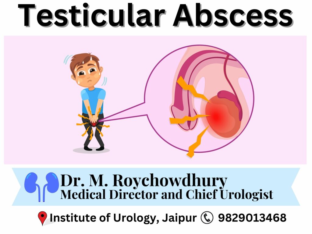 Testicular Abscess Best Doctor Urologist for Treatment Dr. Rajan Bansal Jaipur Rajasthan