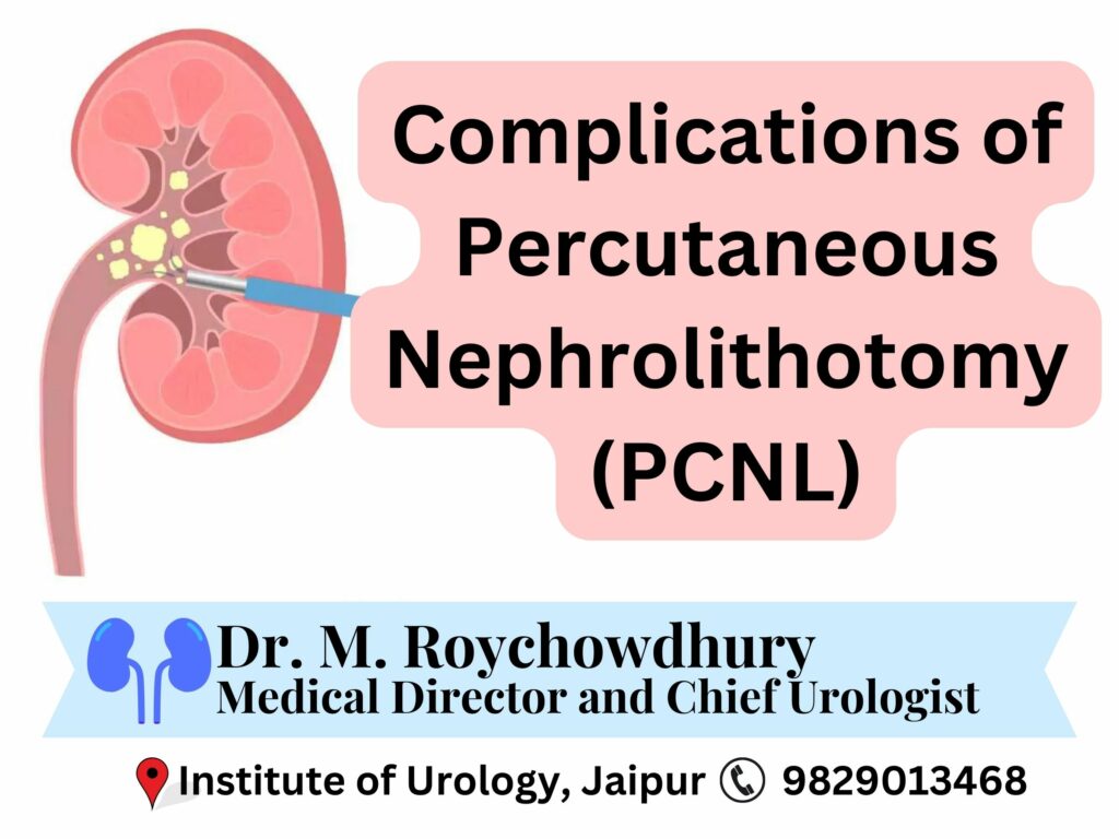 Complications of Percutaneous Nephrolithotomy (PCNL)