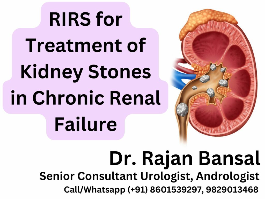 RIRS for Treatment of Kidney Stones in Chronic Renal Failure