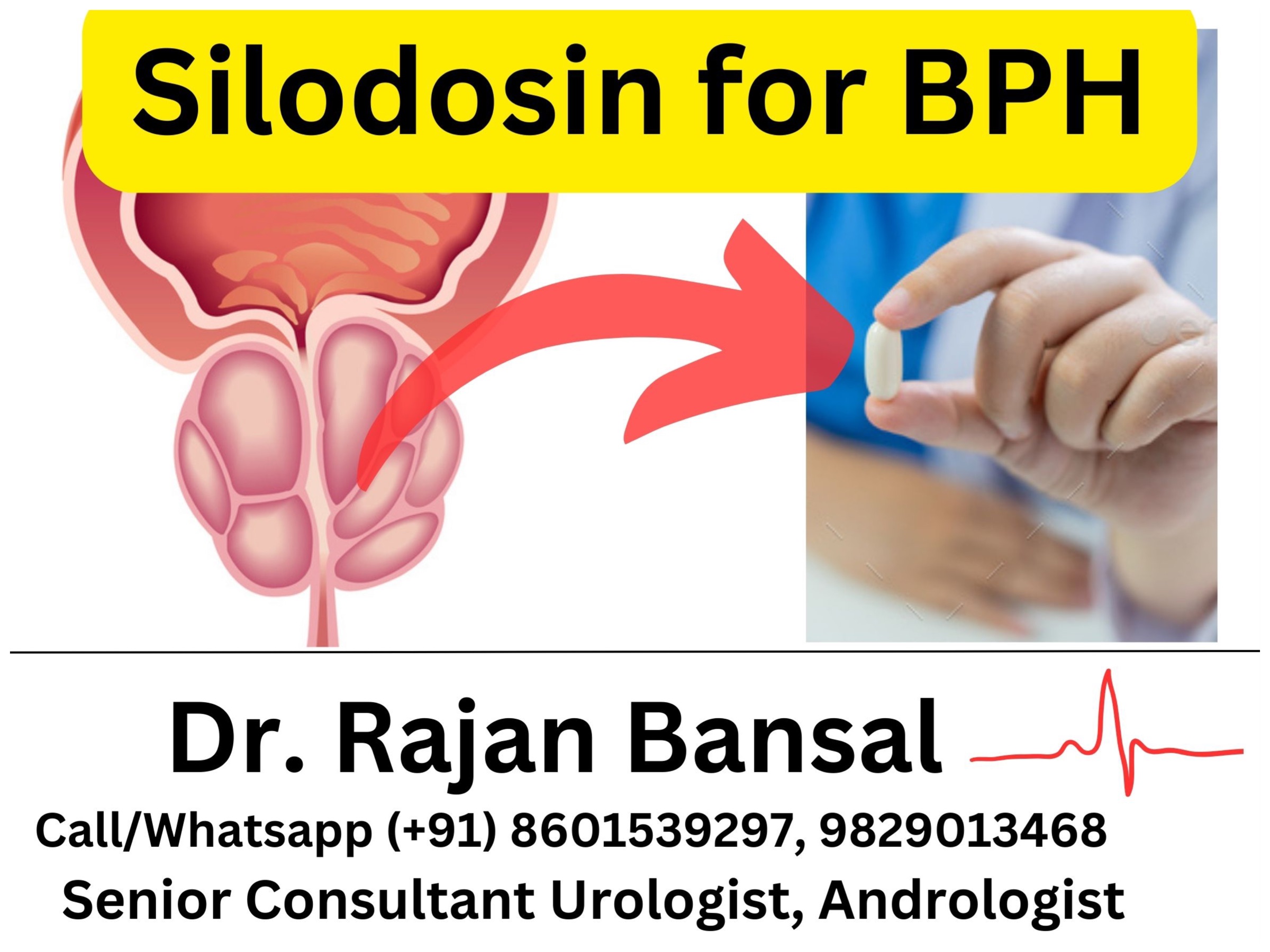 Silodosin - Medicine for Treatment of BPH Dr. Rajan Bansal Best Urologist in Jaipur Rajasthan