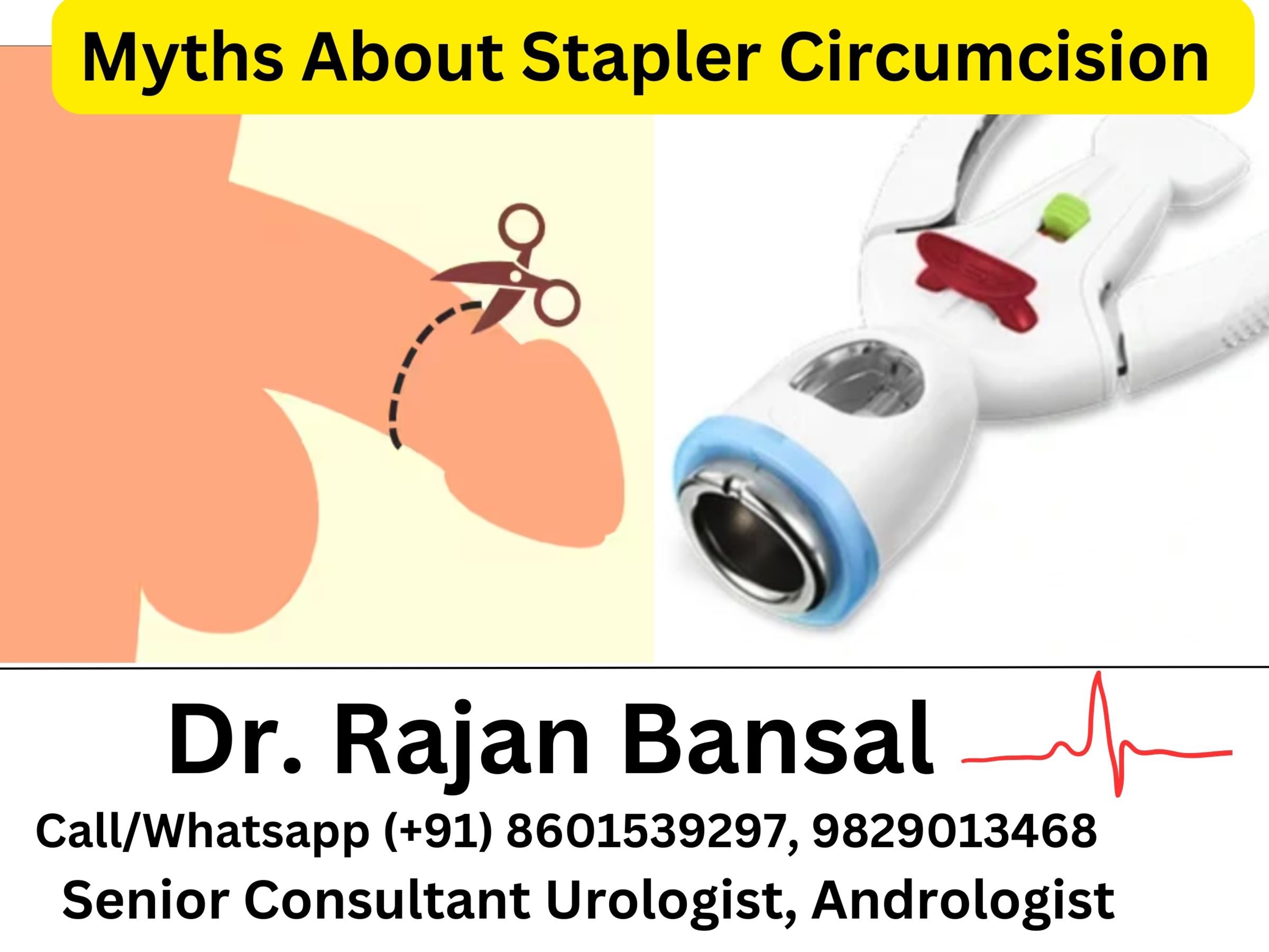 Myths About Stapler Circumcision- Separating Fact from Fiction Dr Rajan Bansal