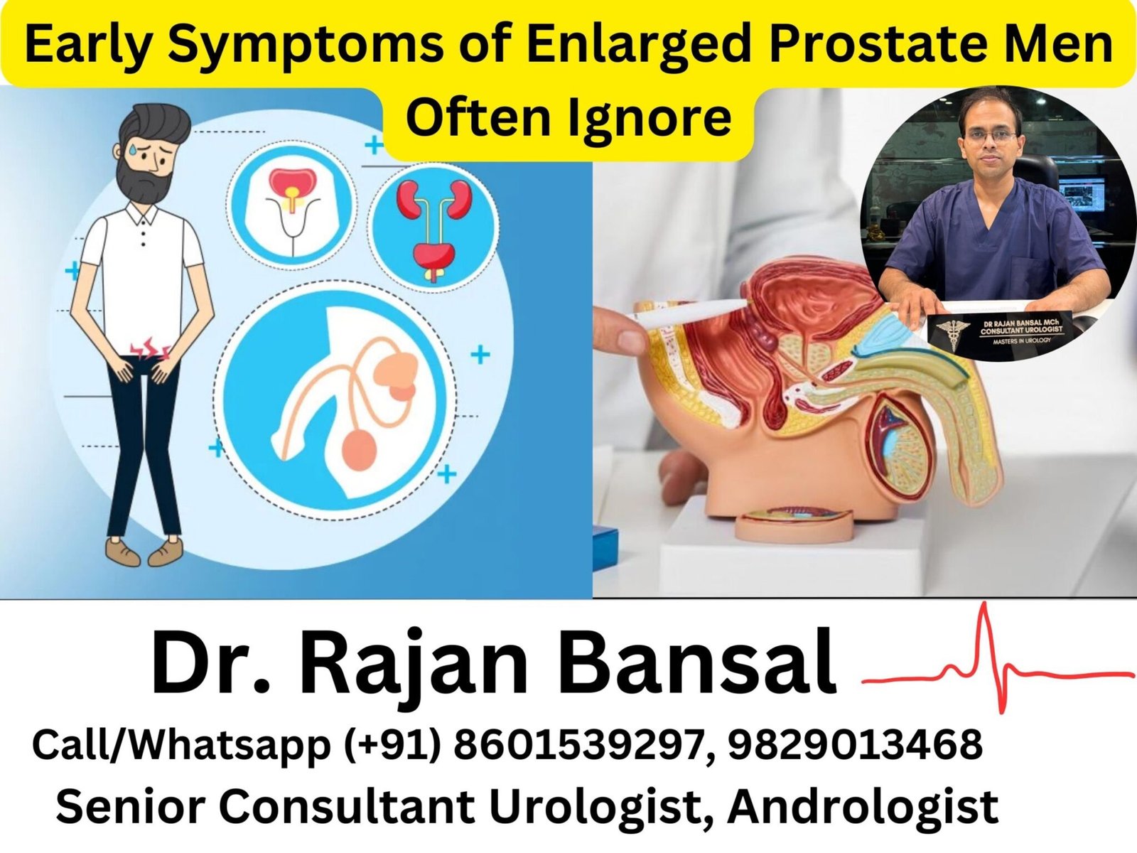 Early Symptoms of Enlarged Prostate Men Often Ignore