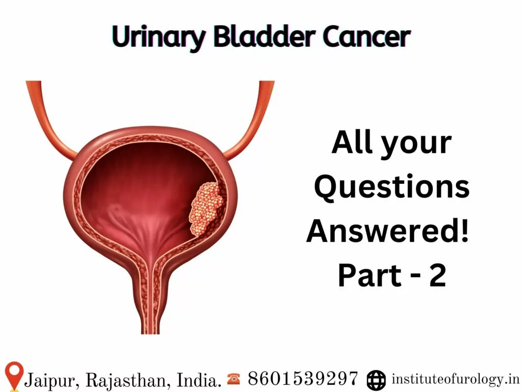 Best hospital for bladder cancer treatemnt in jaipur Dr. Rajan Bansal