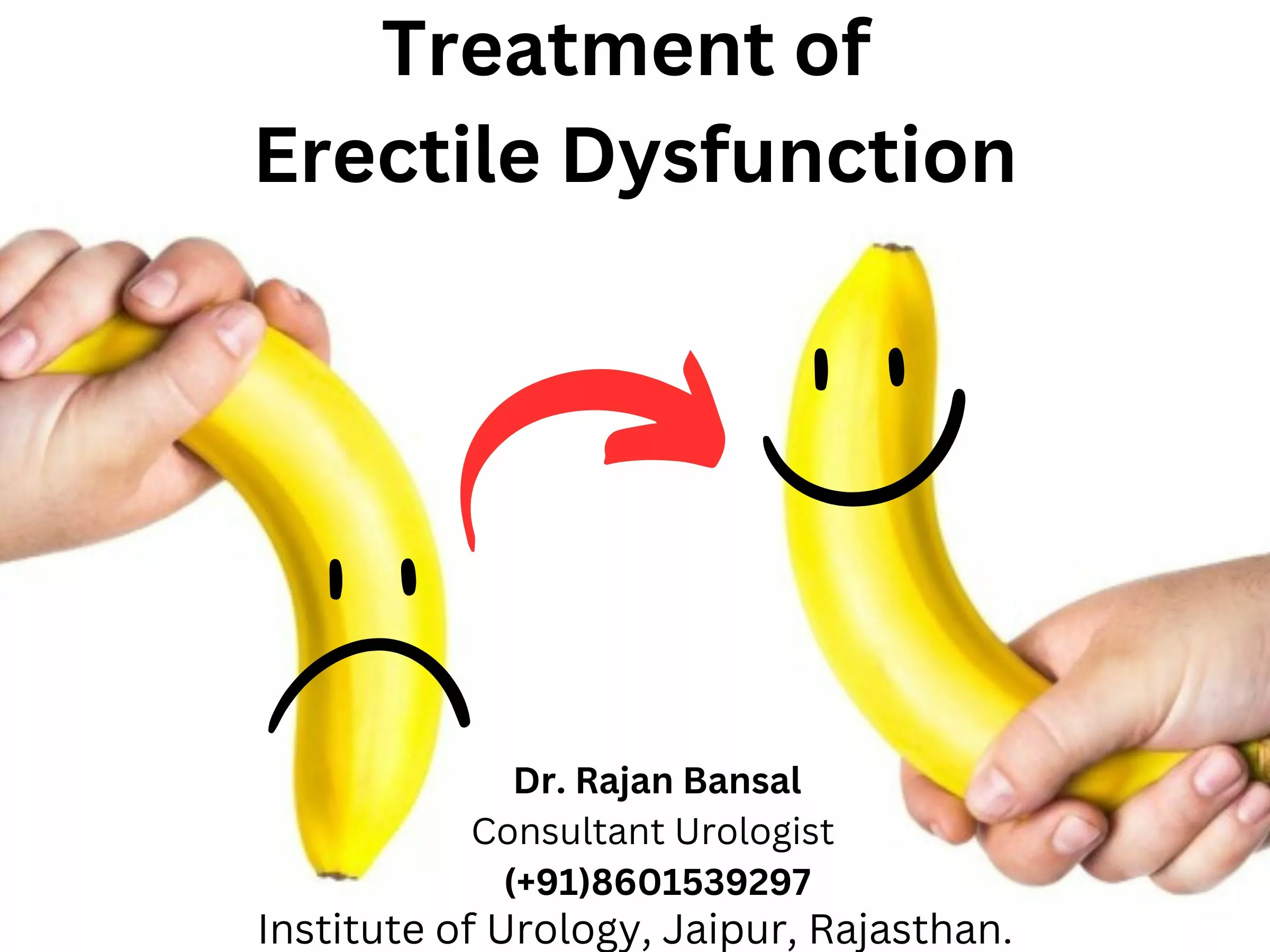 Treatment of Erectile Dysfunction Jaipur Best Urologist Dr. Rajan Bansal