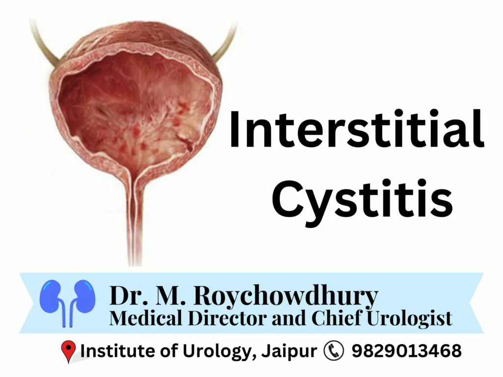 Interstitial Cystitis Treatment Jaipur Rajasthan Best Hospital Dr. Rajan Bansal