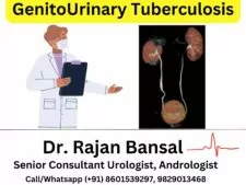 GenitoUrinary Tuberculosis - GUTB Treatment by Dr. Rajan Bansal Jaipur, Rajasthan