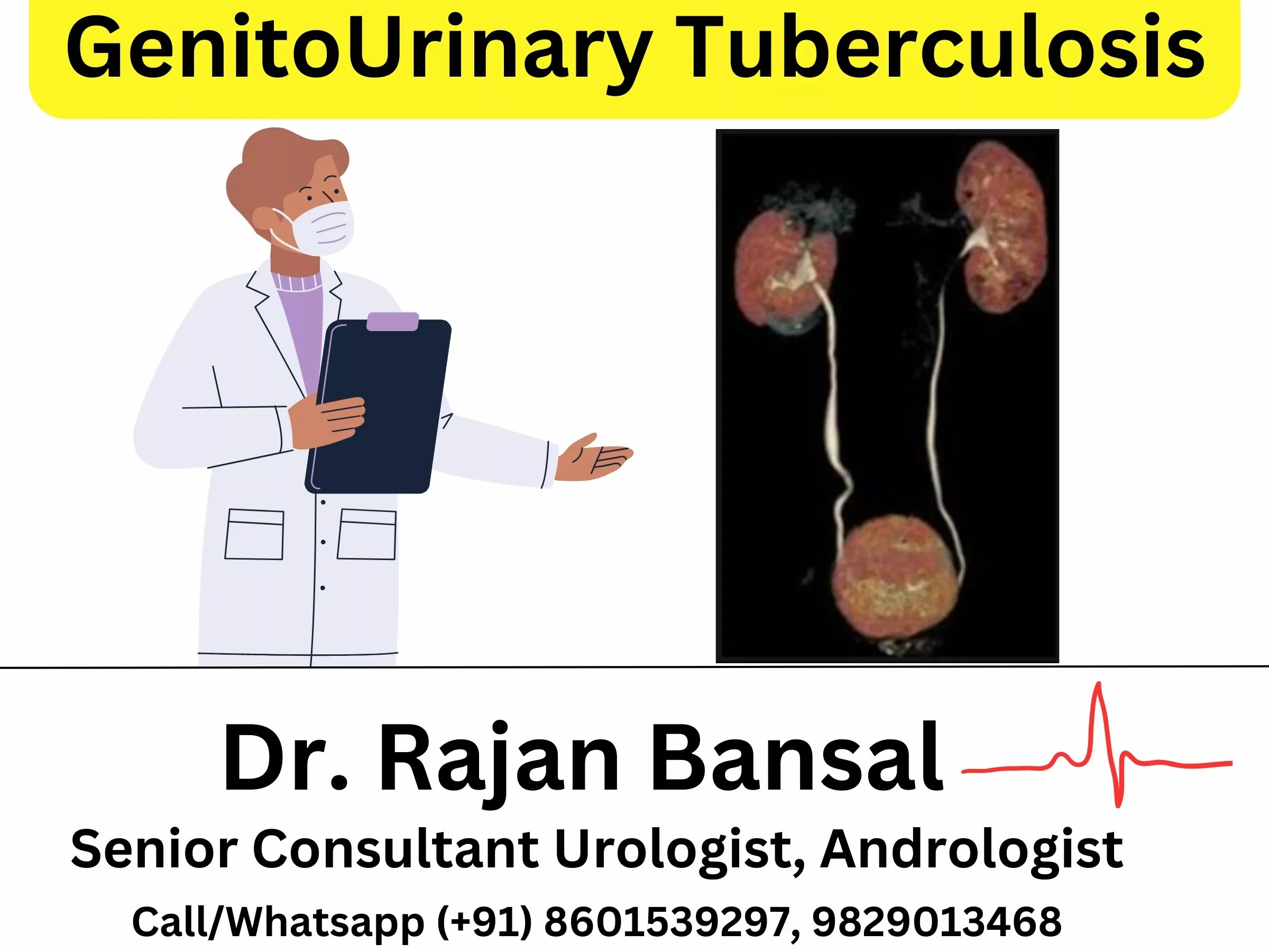 GenitoUrinary Tuberculosis - GUTB Treatment by Dr. Rajan Bansal Jaipur, Rajasthan