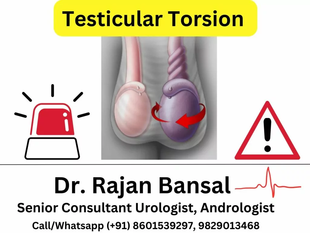 Torsion of Testes : Testicular Torsion Best Doctor in Jaipur Rajasthan Dr Rajan Bansal 8601539297