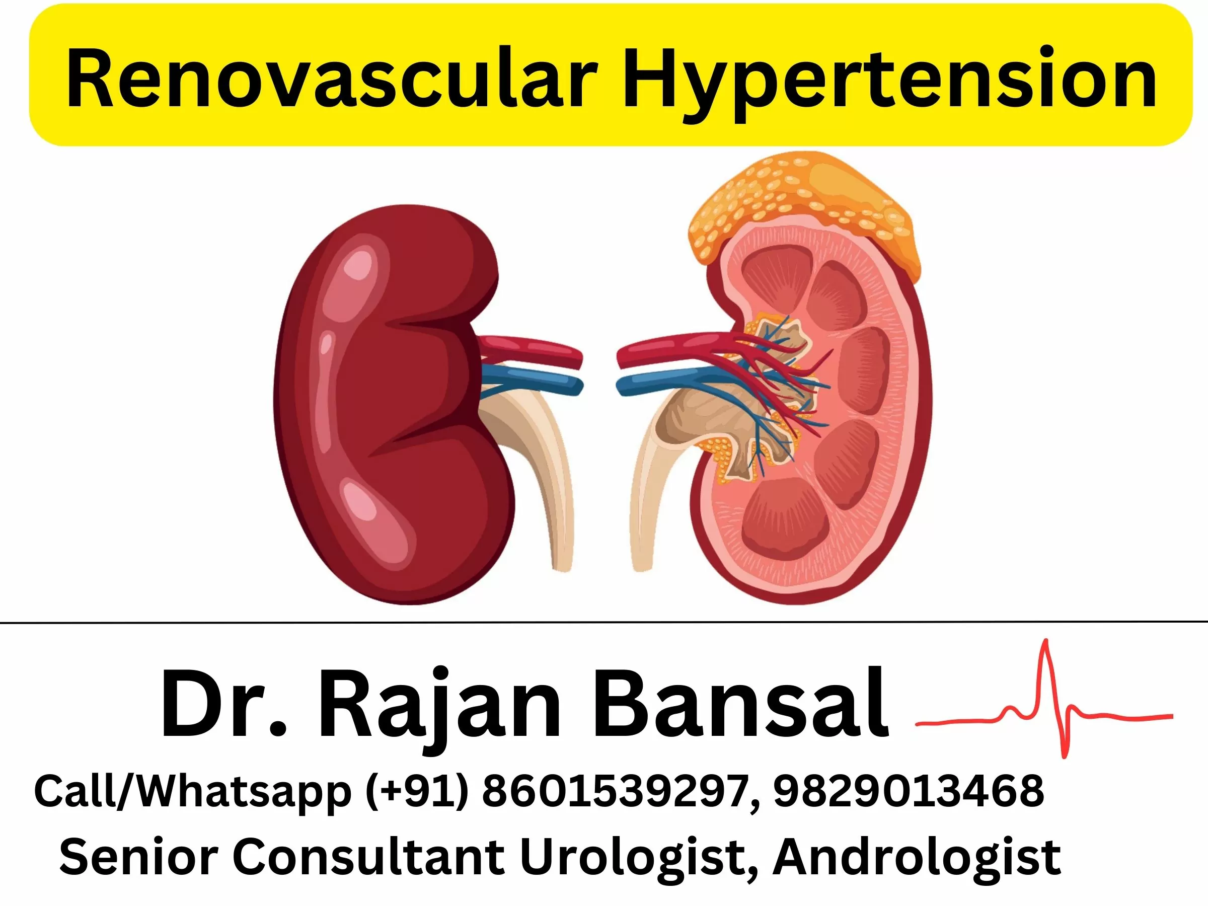 Renovascular Hypertension Treatment Dr Rajan Bansal C Scheme Jaipur Rajasthan